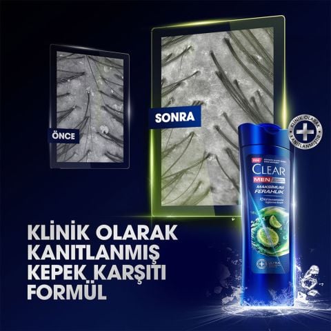 Clear Men Maksimum Ferahlık Yağlı Saç Derisi İçin Limon Özlü Kepeğe Karşı Etkili Şampuan 350 ml
