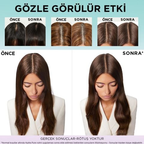 Loreal Paris Elseve Hydra Hyaluronic Pure Salisilik Yağlanma Karşıtı Şampuan 300 ml