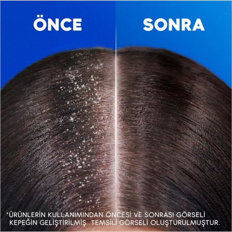 Head & Shoulders Klasik Bakım Kepek Karşıtı Şampuan 330ML