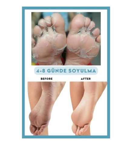 Dermokil Peeling Etkili ( Soyulabilir ) Ayak Maskesi 30 ml