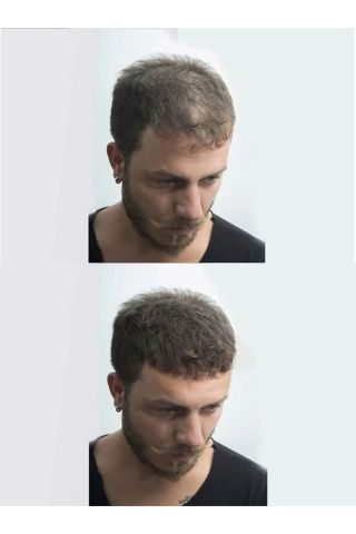 Jaja Topik Dolgunlaştırıcı Siyah Saç Fiberi 50 Gr Black