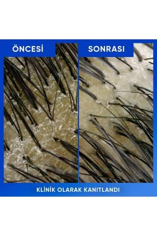 Head & Shoulders Arındırma ve Parlaklık Elma Sirkeli Şampuan Ekonomik Boy 800 Ml