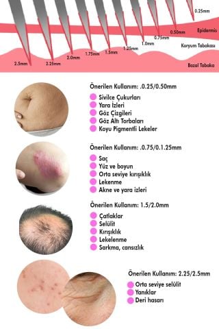 MUJGAN Dermaroller Titanyum 540 İğneli 0.5mm